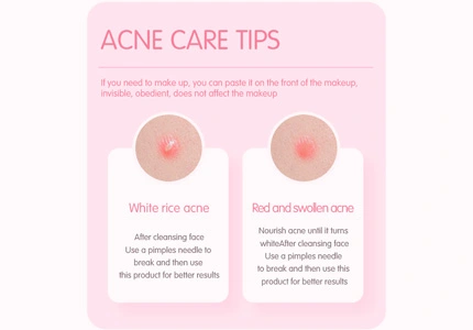 Tratamento da acne