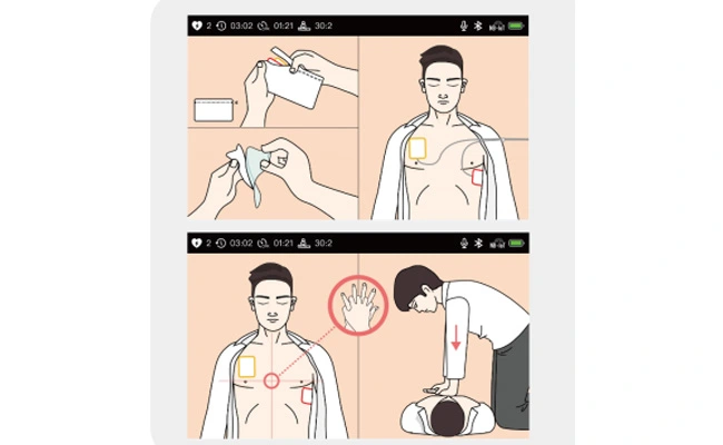 Orientação de operação inteligente